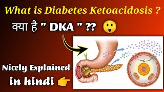 Diabetic Ketoacidosis  What is DKA   in hindi Nursing Guidance  Explanation in hindi [upl. by Meehahs953]