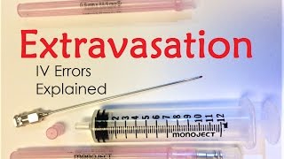 Extravasation  IV Infiltration Errors Explained Doctor Interview [upl. by Gnurt656]