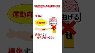 脊髄損傷による麻痺の範囲を大まかに解説！ 勉強 国試対策 国試 [upl. by Steve335]