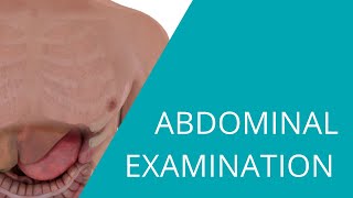 Abdominal Examination  Examination of the abdomen and gastrointestinal system [upl. by Eah]