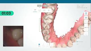 K SCAN Showcase [upl. by Ardnaet]