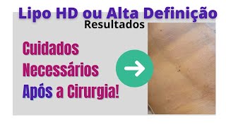 Lipo HD Como melhorar e manter os resultados [upl. by Elad944]