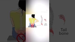 Coccydynia exercises coccydynia physio physiotherapy [upl. by Ratna]