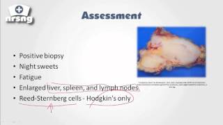 Lymphoma NCLEX® Review  NRSNGacademycom [upl. by Sibylle]