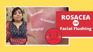 What is Rosacea or Flushing  Rosacea Treatment Causes Symptoms Types amp More  Dr Nivedita Dadu [upl. by Hannazus]