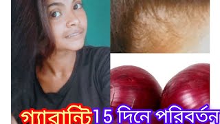 পেঁয়াজ কিভাবে লাগালে নতুন চুল গজাবে  চুল পড়া বন্ধের উপায় Home remedy hair titman 2024 [upl. by Chally]