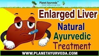 Enlarged Liver Ayurvedic Treatment  Liver Enlargement Natural Treatment [upl. by Heiskell]