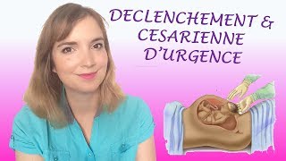 Mon accouchement Déclenchement amp Césarienne durgence [upl. by Kcirddet]