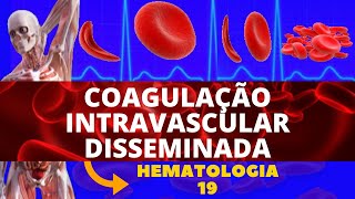 COAGULAÇÃO INTRAVASCULAR DISSEMINADA CIVD  HEMATOLOGIA [upl. by Oicnevuj153]