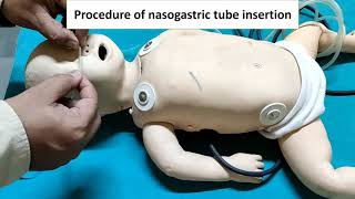 Nasogastric NG Tube Insertion in NeonateNewborn  Orogastric OG TubeFeeding Tube  Paediatric [upl. by Eartnoed]