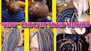 quotStepbyStep Crochet Braids Locs on Severe Alopecia – No Hair No Problemquot [upl. by Sirahc]