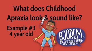 Childhood Apraxia of Speech  Example 3 [upl. by Agnesse460]