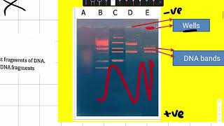 Agarose gel electrophoresis and DNA fingerprinting  Practical [upl. by Namialus]