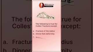 MCQ Series Understanding Colles’ Fracture [upl. by Noell]