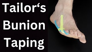 Tailors Bunion Pain Relief Taping [upl. by Anawal276]