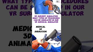 VR Surgery Simulation What types of procedures can be simulated in our VR surgical simulator short [upl. by Ainsley]