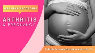 Arthritis Research Education Series Ep 15 Webinar  Arthritis amp Pregnancy [upl. by Eteragram695]