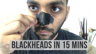 How to Remove Blackheads And Whiteheads From Nose Naturally at Home  ANKIT TV [upl. by Darrow]