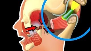 Besonderheiten des Kiefergelenks [upl. by Tsugua]