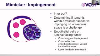 Standardising Tumour Pathology Reporting Lymphovascular Invasion [upl. by Debby]