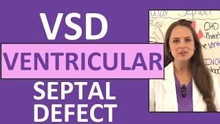 Ventricular Septal Defect Nursing  NCLEX Pediatric Congenital Heart Defects [upl. by Behn]