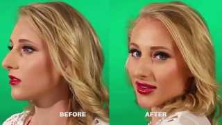 Correct Gummy Smile Naturally With Lip Enhancement Tool [upl. by Jarrett500]