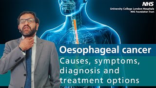 Oesophageal cancer  Causes symptoms diagnosis and treatment options [upl. by Amlev]