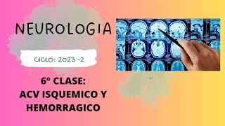 CLASE 6NEUROLOGIA ACV HEMORRAGICO E ISQUEMICO [upl. by Keffer]