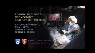 Robotic Singlesite Myomectomy Video  Brigham and Women’s Hospital [upl. by Beaumont]