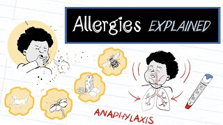 What are Allergies HealthSketch [upl. by Feilak22]