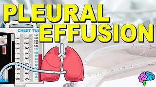 What is a Pleural Effusion EXPLAINED [upl. by Drarrej]