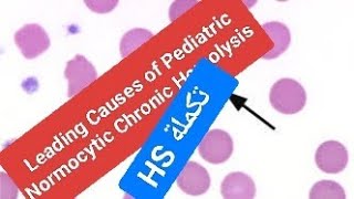 Leading Causes of Pediatric Normocytic Chronic Hemolysis HS تكملة [upl. by Hauhsoj761]