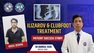 Vikash Vermas Ilizarov amp Clubfoot Treatment Success Story with Dr Shamsul Hoda [upl. by Peterson]