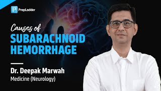 Causes of Subarachnoid Hemorrhage by Dr Deepak Marwah [upl. by Hametaf813]