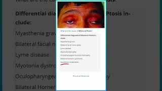 Causes of Bilateral Ptosis [upl. by Lekar61]