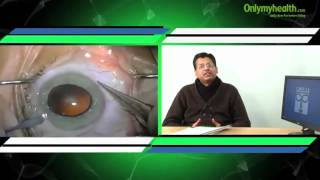 Common Age Related Eye Problems  Onlymyhealthcom [upl. by Siroval]