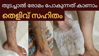 ഒരുദിവസത്തിനുള്ളിൽ Permanent Hair remove packരോമം ഇളകി പോകുന്നത് തെളിവായി കാണാം😱 [upl. by Strohben837]