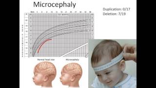 1q211 Neurological Findings and Brain Imaging Studies [upl. by Arabel]