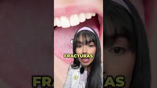 Si tienes un PIERCING EN LA LENGUA mira este video😨 shorts [upl. by Aidul]