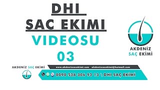 Fue  DHI Kalem Yöntemi ile Saç Ekimi Video 03  DHI Hair Transplant Implanter Pen Technique [upl. by Naylor770]