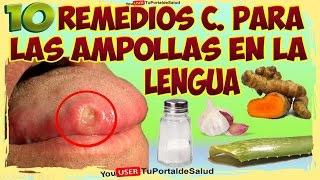 10 Remedios Caseros para las Ampollas en la Lengua [upl. by Cece]