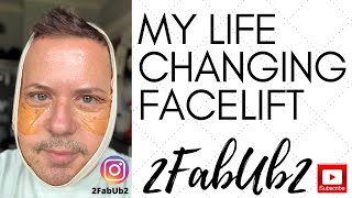 MY FACELIFT JOURNEY BEFORE AND AFTER [upl. by Uolymme542]