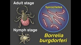 LongerTerm Therapy for Lyme Disease [upl. by Ynobe311]