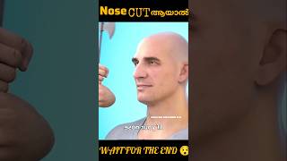 Nose cut ആയാൽWAIT FOR THE END 😯 [upl. by Bhayani]