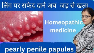 pearly penile papules symptoms and homeopathic medicine लिंग पर सफेद दाने का बिना सर्जरी इलाज [upl. by Torre]