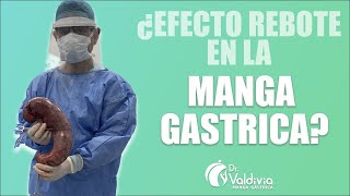 👀 MANGA GASTRICA CONSECUENCIAS  🤔¿EFECTO REBOTE  👨‍⚕TODO LO QUE NECESITAS SABER BIEN EXPLICADO [upl. by Addiego]