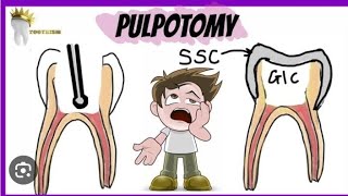 شرح pulpotomy للأسنان اللبنية بالعربي [upl. by Dutch]