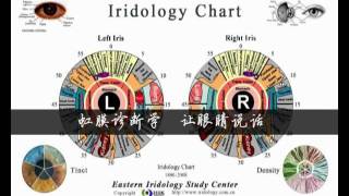 Iridology Cameras  iridology  IriscopeHSK HealthCare [upl. by Prudie927]