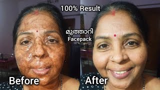 Secret amp Best Ragi Powder Face Pack 👌 Skin whitening Face Pack  ragi face pack malayalam [upl. by Ynnaj]