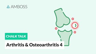 Arthritis amp Osteoarthritis  Part 4 Joint Involvement Patterns in Rheumatic Diseases [upl. by Aisya]